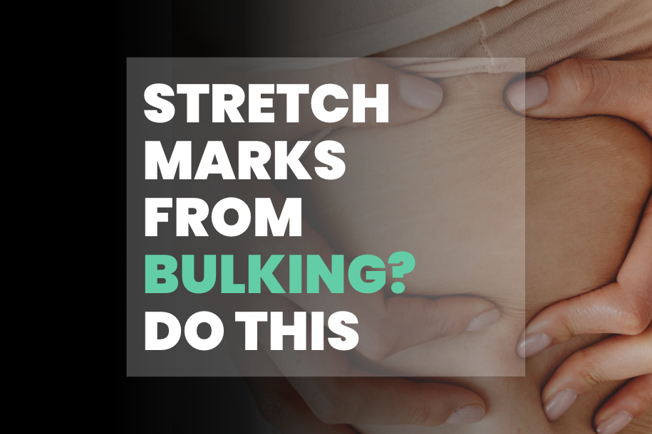 Stretch Marks From Bulking